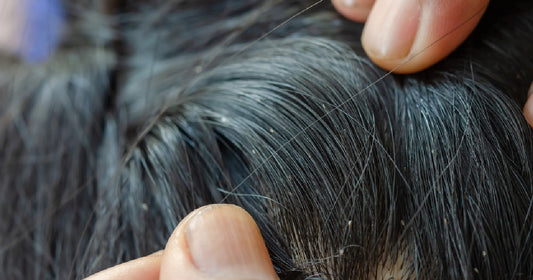 What is the difference between nits, eggs and lice