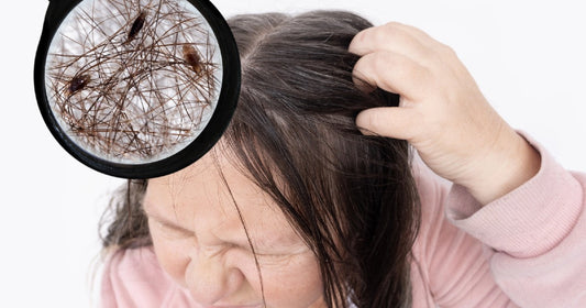 can you see head lice with the naked eye